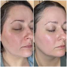 Super Glow Pack - ( 6 Masks + Rose Water)